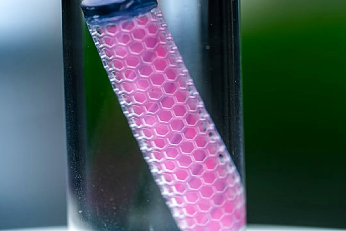 Prototip implantata za liječenje raka jajnika, gušterače i drugih teško izlječivih karcinoma 📷 Rice University